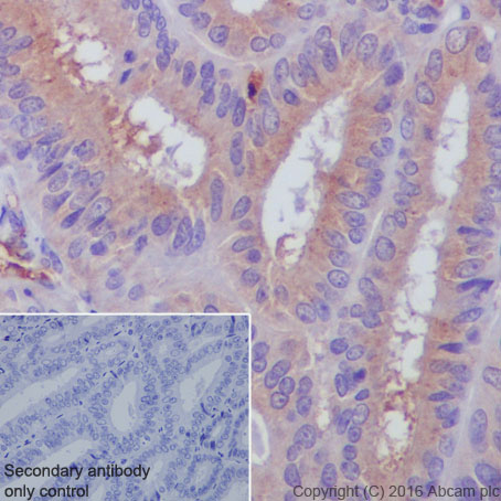 Immunohistochemistry (Formalin/PFA-fixed paraffin-embedded sections) - Anti-Serum Amyloid P/SAP antibody [EP1018Y] - BSA and Azide free (AB232468)