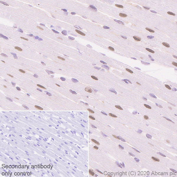Immunohistochemistry (Formalin/PFA-fixed paraffin-embedded sections) - Anti-Serum Response Factor SRF antibody [2C5] - BSA and Azide free (ab255871), expandable thumbnail