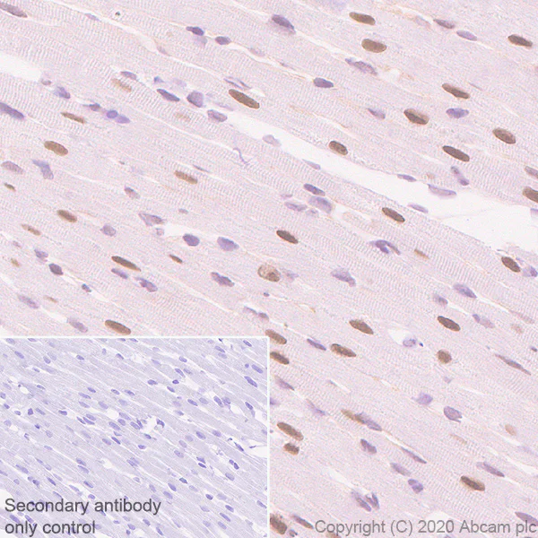 Immunohistochemistry (Formalin/PFA-fixed paraffin-embedded sections) - Anti-Serum Response Factor SRF antibody [2C5] - BSA and Azide free (AB255871)
