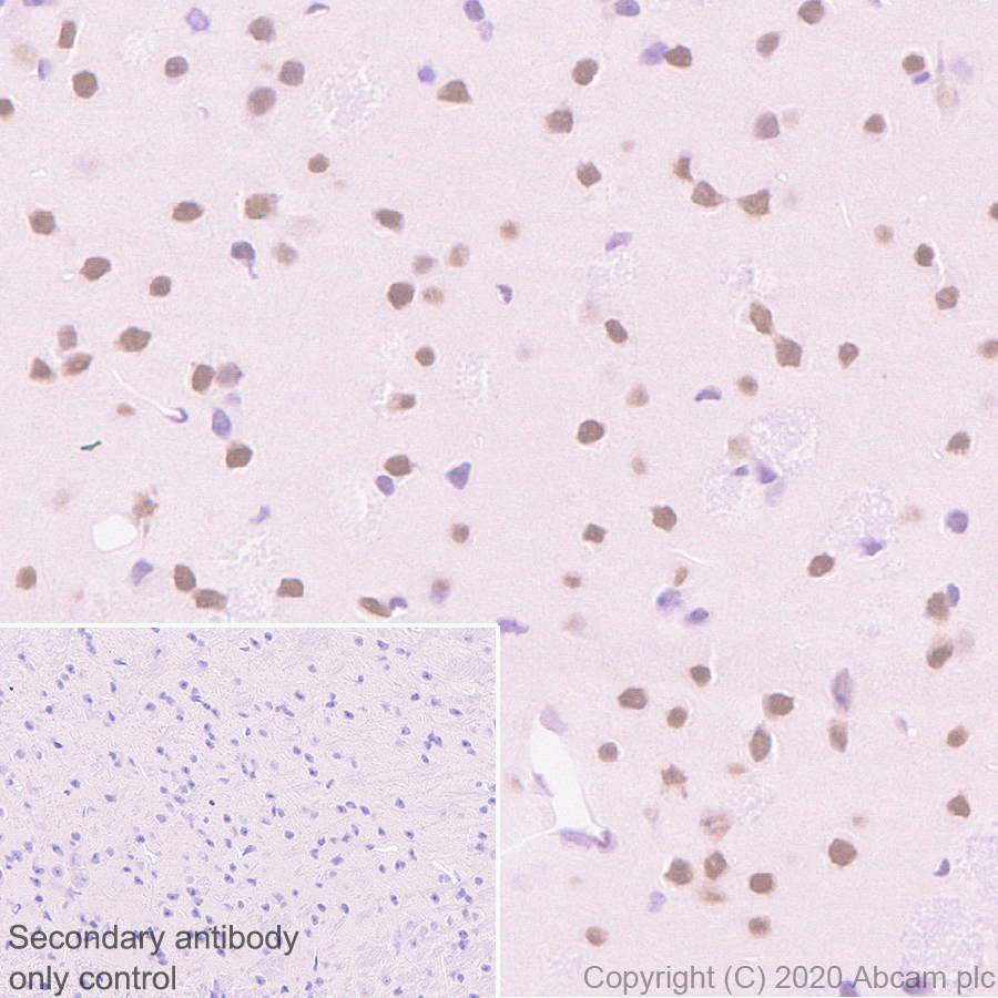 Immunohistochemistry (Formalin/PFA-fixed paraffin-embedded sections) - Anti-Serum Response Factor SRF antibody [2C5] - BSA and Azide free (AB255871), expandable thumbnail