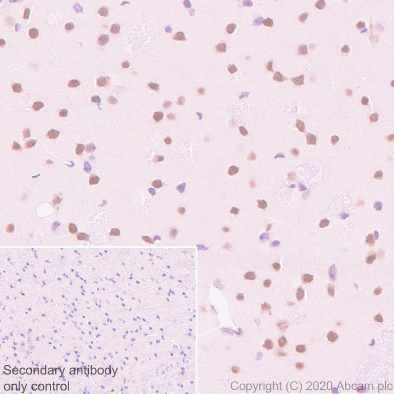 Immunohistochemistry (Formalin/PFA-fixed paraffin-embedded sections) - Anti-Serum Response Factor SRF antibody [2C5] - BSA and Azide free (AB255871)