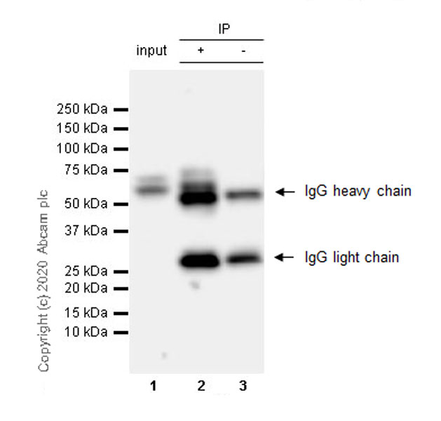 Immunoprecipitation - Anti-Serum Response Factor SRF antibody [2C5] - BSA and Azide free (AB255871), expandable thumbnail