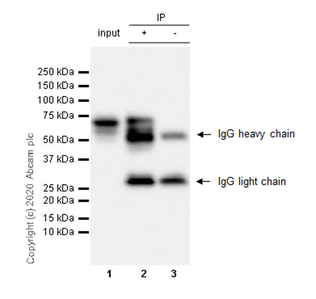Immunoprecipitation - Anti-Serum Response Factor SRF antibody [2C5] - BSA and Azide free (AB255871)