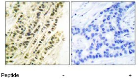 Immunohistochemistry (Formalin/PFA-fixed paraffin-embedded sections) - Anti-Serum Response Factor SRF antibody (AB53147)