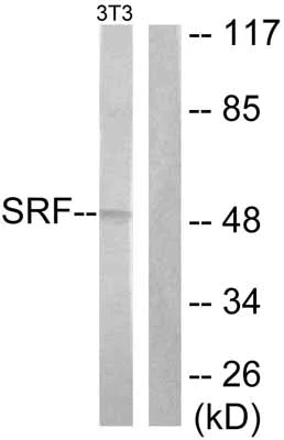 Western blot - Anti-Serum Response Factor SRF antibody (AB53147)