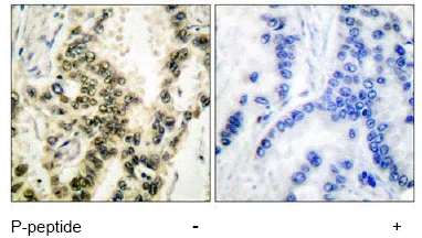 Immunohistochemistry (Formalin/PFA-fixed paraffin-embedded sections) - Anti-Serum Response Factor SRF (phospho S103) antibody (AB53130)