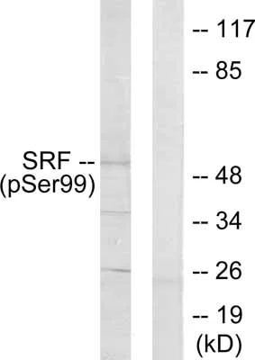 Western blot - Anti-Serum Response Factor SRF (phospho S103) antibody (AB53130)