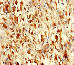 Immunohistochemistry (Formalin/PFA-fixed paraffin-embedded sections) - Anti-Seryl-tRNA synthetase/SERS antibody (AB235789)