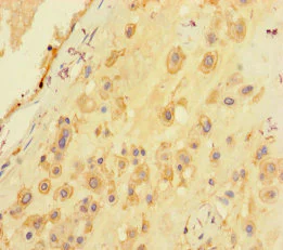 Immunohistochemistry (Formalin/PFA-fixed paraffin-embedded sections) - Anti-Seryl-tRNA synthetase/SERS antibody (AB235789)