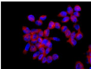 Immunocytochemistry/ Immunofluorescence - Anti-Seryl-tRNA synthetase/SERS antibody [EPR10684(B)] (AB154825), expandable thumbnail