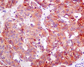 Immunohistochemistry (Formalin/PFA-fixed paraffin-embedded sections) - Anti-Seryl-tRNA synthetase/SERS antibody [EPR10684(B)] (AB154825), expandable thumbnail