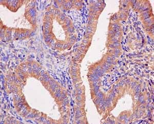 Immunohistochemistry (Formalin/PFA-fixed paraffin-embedded sections) - Anti-Seryl-tRNA synthetase/SERS antibody [EPR10685] (AB183025)