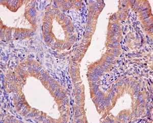 Immunohistochemistry (Formalin/PFA-fixed paraffin-embedded sections) - Anti-Seryl-tRNA synthetase/SERS antibody [EPR10685] - BSA and Azide free (AB250642)