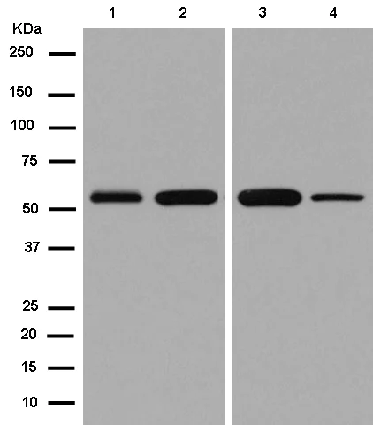 Western blot - Anti-Seryl-tRNA synthetase/SERS antibody [EPR10685] - BSA and Azide free (AB250642)
