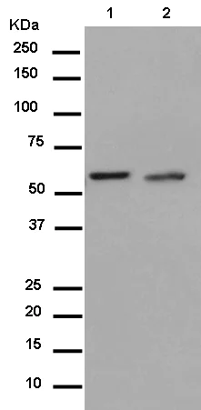 Western blot - Anti-Seryl-tRNA synthetase/SERS antibody [EPR10685] - BSA and Azide free (AB250642)