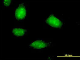 Immunocytochemistry/ Immunofluorescence - Anti-SESN1 antibody (AB67156)