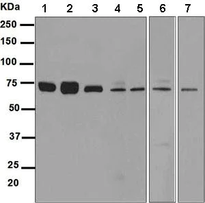 Western blot - Anti-SESN1 antibody [EPR1930(2)] (AB134091)