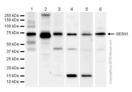 Western blot - Anti-SESN1 antibody [EPR1930(2)] (AB134091)