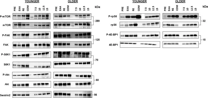 Western blot - Anti-SESN2/Sestrin-2 antibody [EPR18907] (AB178518)