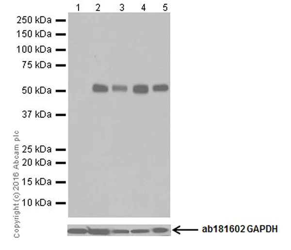 Western blot - Anti-SESN2/Sestrin-2 antibody [EPR18907] (AB178518)