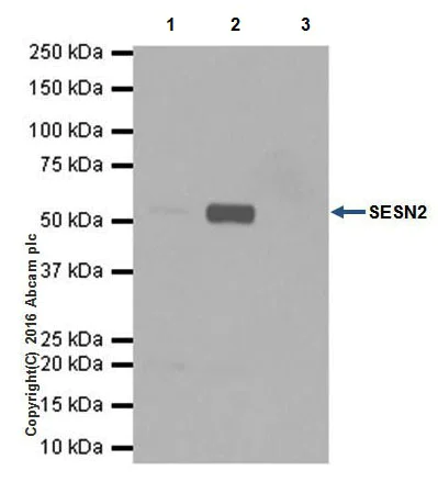 Immunoprecipitation - Anti-SESN2/Sestrin-2 antibody [EPR18907] - BSA and Azide free (AB236025)