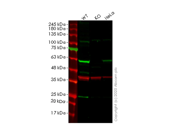Western blot - Anti-SESN2/Sestrin-2 antibody [EPR18907] - BSA and Azide free (AB236025)