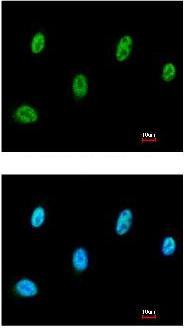Immunocytochemistry/ Immunofluorescence - Anti-SESN3 antibody (AB97792), expandable thumbnail