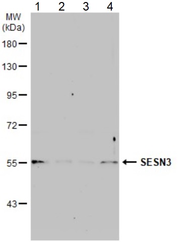 Western blot - Anti-SESN3 antibody (AB97792), expandable thumbnail