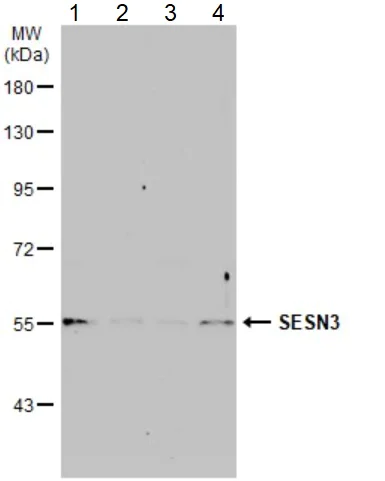 Western blot - Anti-SESN3 antibody (AB97792)