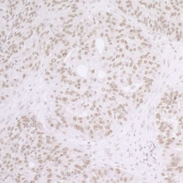 Immunohistochemistry (Formalin/PFA-fixed paraffin-embedded sections) - Anti-SET/TAF-I antibody (AB92872), expandable thumbnail