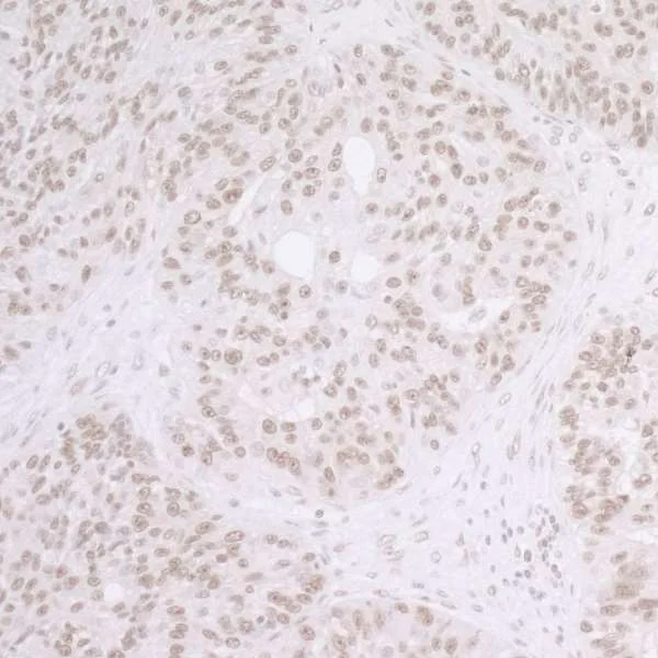 Immunohistochemistry (Formalin/PFA-fixed paraffin-embedded sections) - Anti-SET/TAF-I antibody (AB92872)