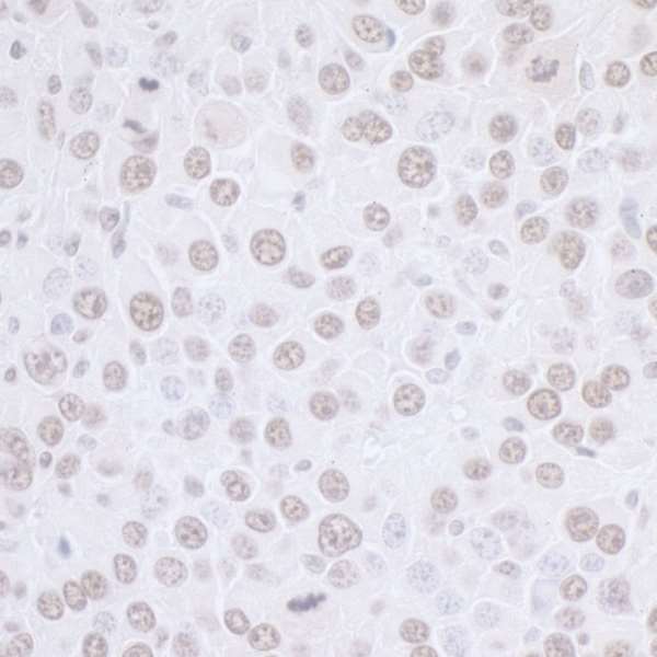 Immunohistochemistry (Formalin/PFA-fixed paraffin-embedded sections) - Anti-SET/TAF-I antibody (AB92872), expandable thumbnail