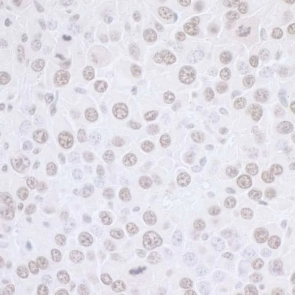 Immunohistochemistry (Formalin/PFA-fixed paraffin-embedded sections) - Anti-SET/TAF-I antibody (AB92872)