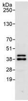 Immunoprecipitation - Anti-SET/TAF-I antibody (AB92872)
