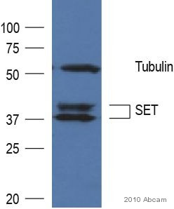 Western blot - Anti-SET/TAF-I antibody (AB92872), expandable thumbnail