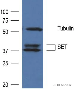 Western blot - Anti-SET/TAF-I antibody (AB92872)