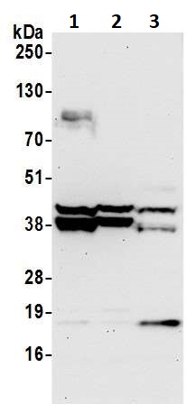 Western blot - Anti-SET/TAF-I antibody (AB92872), expandable thumbnail