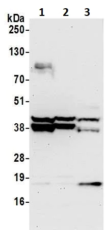 Western blot - Anti-SET/TAF-I antibody (AB92872)