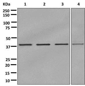 Western blot - Anti-SET/TAF-I antibody [EPR12972(B)] (AB176567)