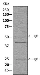 Immunoprecipitation - Anti-SET/TAF-I antibody [EPR12972(B)] - BSA and Azide free (AB249926)