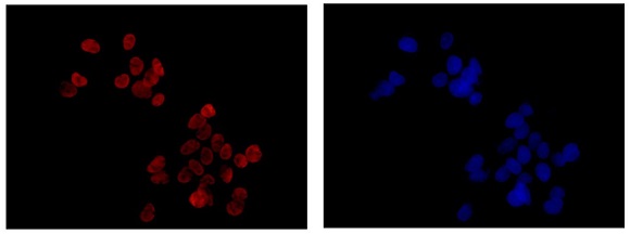 Immunocytochemistry/ Immunofluorescence - Anti-SET/TAF-I antibody [EPR12973] (ab181990), expandable thumbnail
