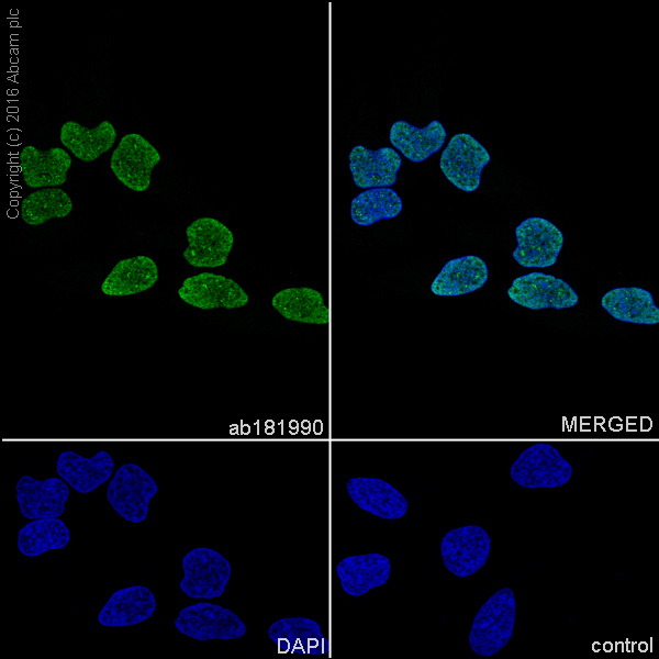 Immunocytochemistry/ Immunofluorescence - Anti-SET/TAF-I antibody [EPR12973] (AB181990), expandable thumbnail