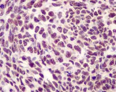 Immunohistochemistry (Formalin/PFA-fixed paraffin-embedded sections) - Anti-SET/TAF-I antibody [EPR12973] (AB181990)