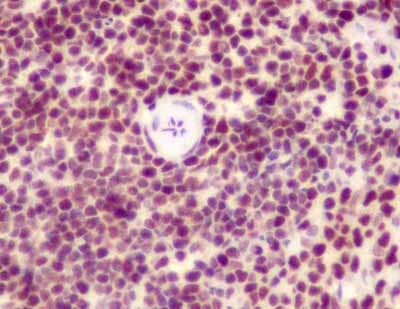Immunohistochemistry (Formalin/PFA-fixed paraffin-embedded sections) - Anti-SET/TAF-I antibody [EPR12973] (AB181990), expandable thumbnail