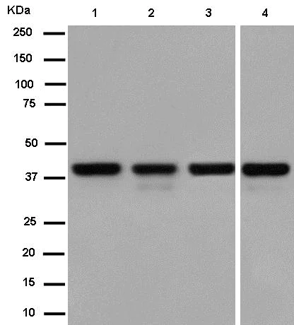 Western blot - Anti-SET/TAF-I antibody [EPR12973] (AB181990)