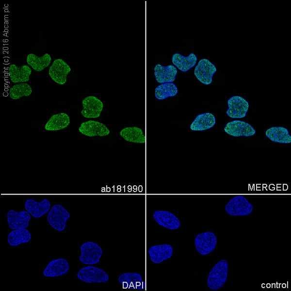 Immunocytochemistry/ Immunofluorescence - Anti-SET/TAF-I antibody [EPR12973] - BSA and Azide free (AB235387)