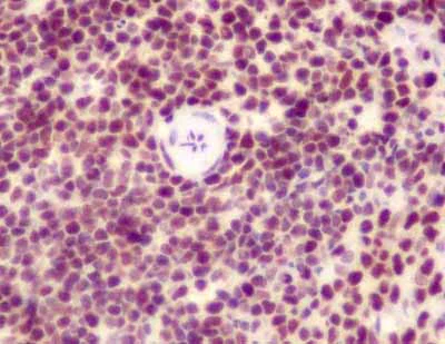 Immunohistochemistry (Formalin/PFA-fixed paraffin-embedded sections) - Anti-SET/TAF-I antibody [EPR12973] - BSA and Azide free (AB235387)