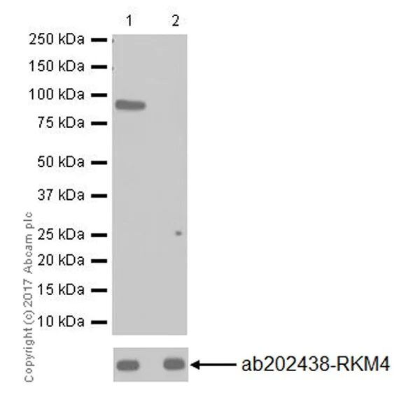 Western blot - Anti-SET3 antibody [EPR20101] (AB202434)