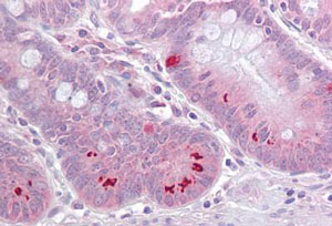 Immunohistochemistry (Formalin/PFA-fixed paraffin-embedded sections) - Anti-SET7 antibody (AB189347)