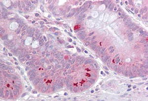 Immunohistochemistry (Formalin/PFA-fixed paraffin-embedded sections) - Anti-SET7 antibody (AB189347)